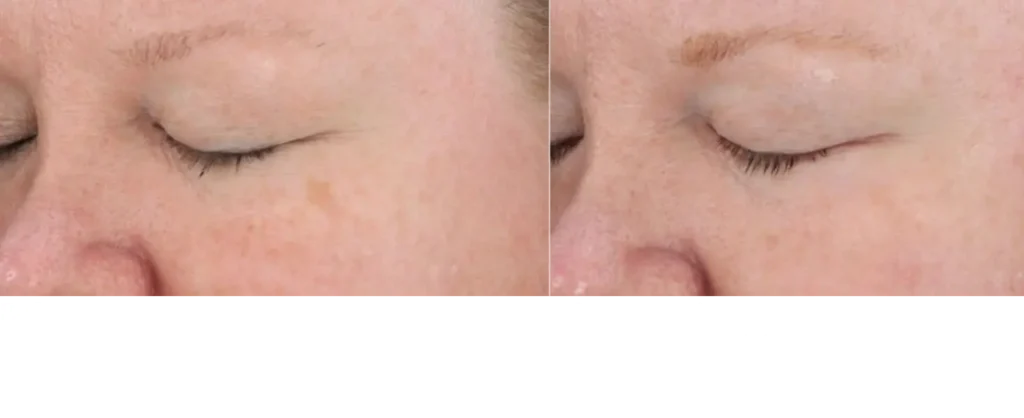 Revision Skincare Retinol Complete