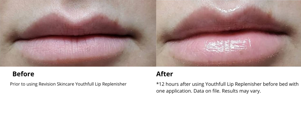 youthful lip replenisher reviews