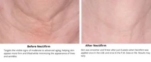 Nectifirm