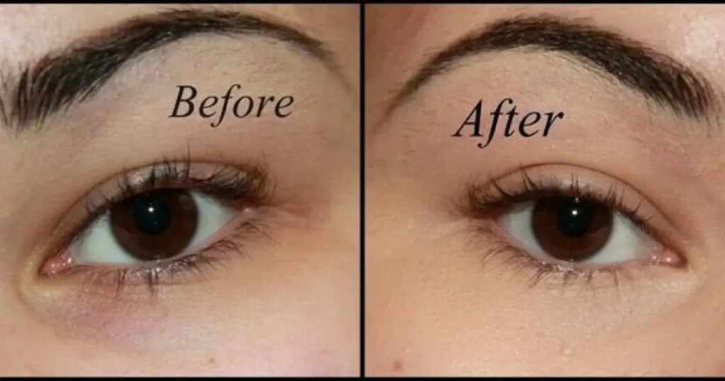 revision vitamin k serum