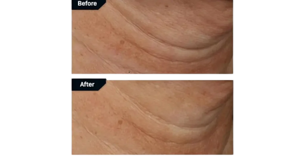 nectifirm