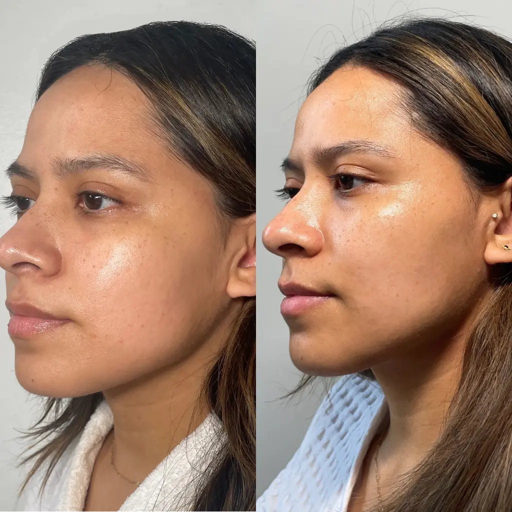 alastin vs skinceuticals