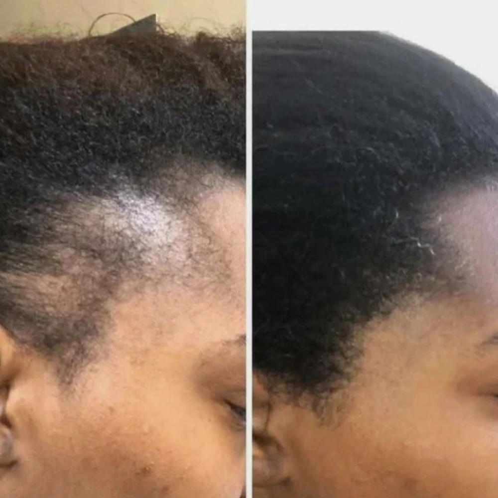 chebe hair butter reviews