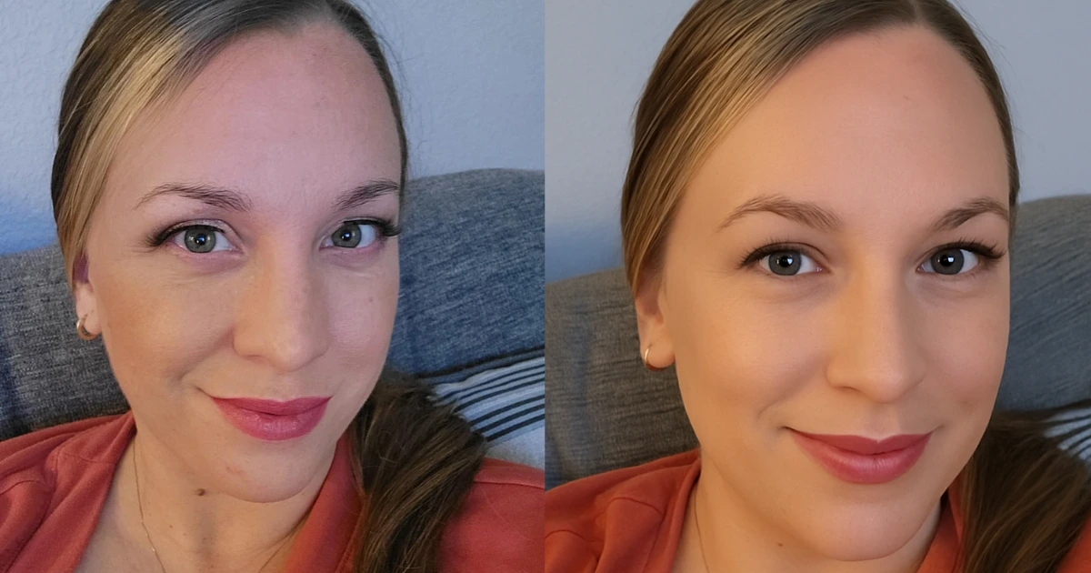 skinmedica vitalize chemical peel